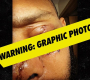 ‘ထိပ်တန်းစားဖိုမှူး’ စတား Justin Sutherland သည် စက်လှေမတော်တဆမှုမှ Gnarly ဒဏ်ရာဓာတ်ပုံကို မျှဝေခဲ့သည်။