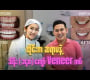 ထိုင်းရောက်တုန်း Veneer ကပ် Vlog